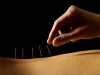 Acupuncture & Traditional Chinese Medicine